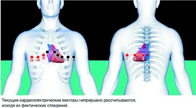 Методические рекомендации Регистрации ЭКГ покоя в 12 общеприня- тых от