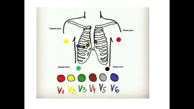 Методические рекомендации Регистрации ЭКГ покоя в 12 общеприня- тых от