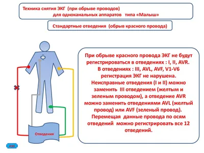 Измерение температуры, снятие ЭКГ, мониторинг ЧСС — и никаких поликлиник.  Oppo представила OHealth H1 для биомониторинга на