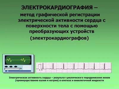 Техника снятия ЭКГ - презентация онлайн