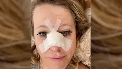 ФОТО: Как выглядит Ксения Собчак после пластической операции - Бублик