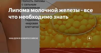 Заболевания молочных желез у женщин: виды, симптомы, диагностика и лечение