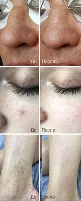 Структурное старение лица | Интеллектуальная косметология Face Clinic