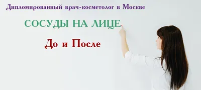 Удалить сосуды на лице