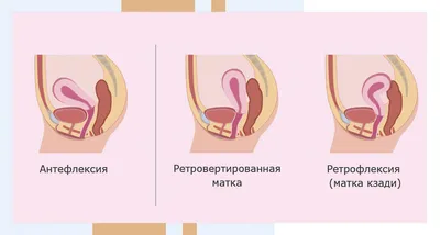 Синехия крайней плоти в Киеве - записаться на разделение синехий крайней  плоти в клинике, доступная цена процедуры