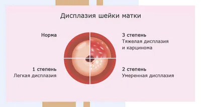 PH влагалища – что это, какова норма? Рекомендации гинеколога клиники  АльтраВита