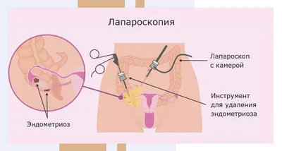 Фимоз у мужчин: лечение, причины, симптомы и диагностика. Урология