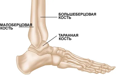 Перелом костей голени