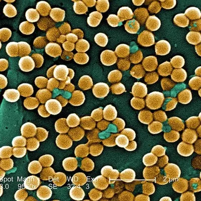 Диабет 2-го типа может вызываться бактериями, выяснили ученые - РИА  Новости, 02.06.2015