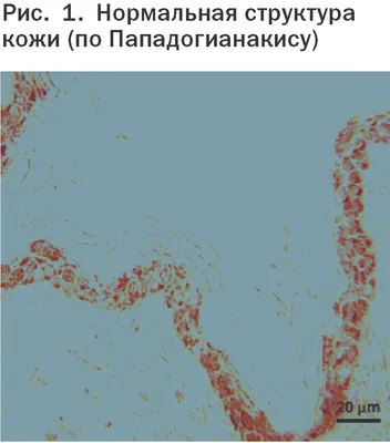 Блошиный дерматит у кошек: симптомы, лечение, профилактика