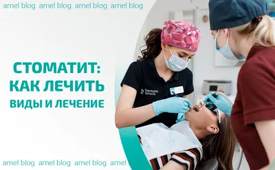 Стоматит ᐉ лечение, виды и симптомы - Amel Dental Clinic