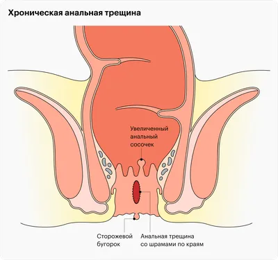 Сторожевой бугорок фото фотографии