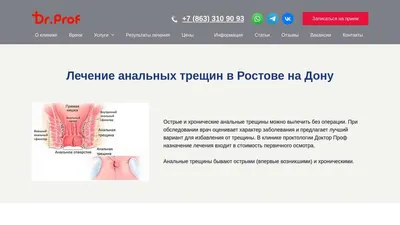 RU2774576C1 - Способ лечения хронической анальной трещины - Google Patents