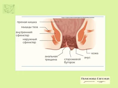 Немного про пугающую кровь из прямой кишки у ребенка. 13 карточек  #детскаяхирургия #детскийпроктолог | Евгения Пименова | Дзен