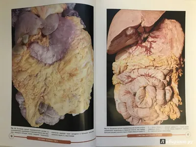 Анатомия человека. Атлас. Том 3. Учение о нервной системе, М. Р. Сапин –  скачать pdf на ЛитРес