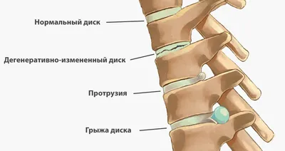 Поясничный отдел позвоночника