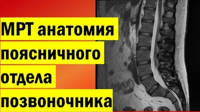 Нарушения позвоночника (анатомия человека) плакат глянцевый А2+, плотная  фотобумага от 200г/м2 - купить с доставкой по выгодным ценам в  интернет-магазине OZON (262614933)
