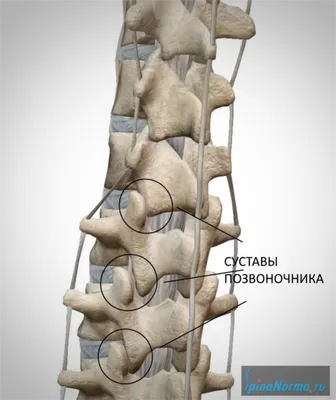 МРТ анатомия поясничного отдела позвоночника | Как выглядит позвоночник на  МРТ - YouTube