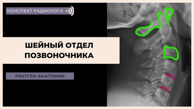 Поясничный отдел позвоночника