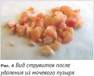 Струвит — Википедия