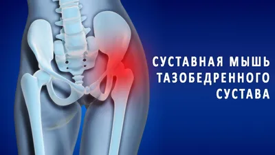 Артроскопия коленного сустава | Услуги травматолога-ортопеда в Челябинске —  прием и консультация | Клиника «Эф Эм Си» (FMC)