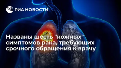 Названы шесть \"кожных\" симптомов рака, требующих срочного обращения к врачу  - РИА Новости, 23.01.2022