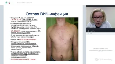 Демодекоз: лечение, причины, симптомы, признаки, фото, цены - Медицинский  центр «Дезир» Санкт-Петербург.