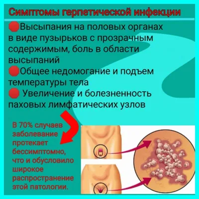 Высыпания на коже у детей | Городской кожно-венерологический диспансер