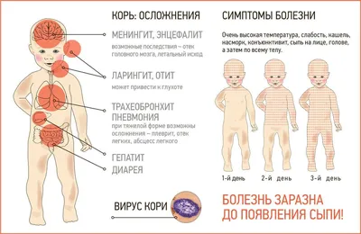 Сыпь на коже у ребенка – причины и методы лечения