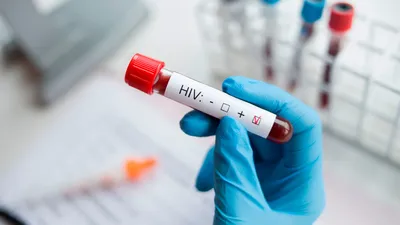 Эксперты рассказали, как распознать ВИЧ по симптомам