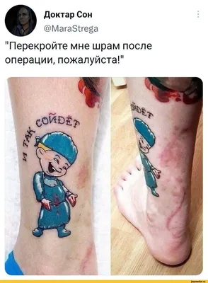 Татуировки, как перекрытие послеоперационных шрамов — тату салон в Киеве  «TST»