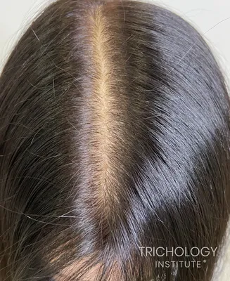Трихопигментация волос в СПб цена салон красоты