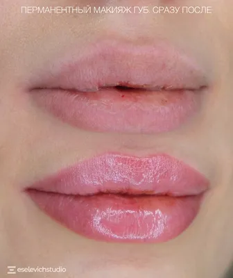Как долго заживают губы после перманентного макияжа? Краткий обзор методов  лечения.
