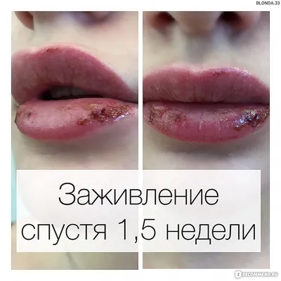 Фото перманентного макияжа губ от косметологов салона
