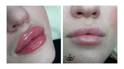 Татуаж губ 3Д – фото до и после процедуры| Перманентный макияж губ в 3D  технике