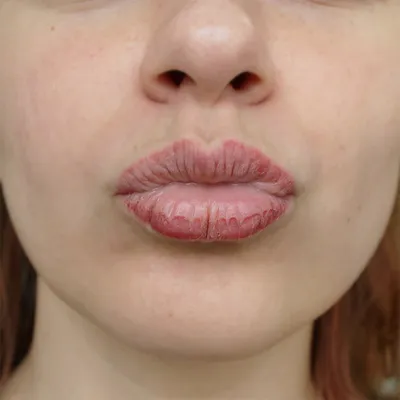 Татуаж Туапсе - 👄Сексуальность на виду...👄 ⠀ 💄Это я про губы которые  всегда выражают женскую сексуальность🥰 ⠀ 🍭Процесс заживления  перманентного макияжа губ ⠀ 💫Процедура перманентного макияжа(татуажа)  сложный процесс. ⠀ 📢 Собираясь на