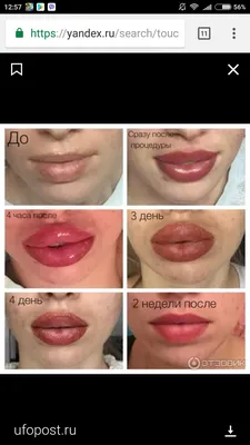 Pin by Ruth B on New me | Fuller lips makeup, Lip permanent makeup, Lip  fillers