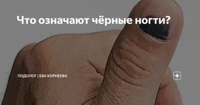 Темные пятна на ногтях - основные причины и лечение