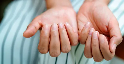 Следи за ногами. 10 признаков болезней, которые нельзя упустить |  AnnaSuvorova69 | Дзен
