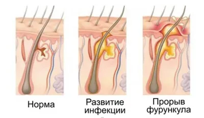 Малышева: признаком рака могут быть темные полоски на коже. Врачи так не  думают | 360°