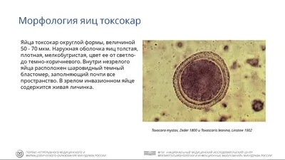 Токсокароз: современные подходы к проблеме - YouTube