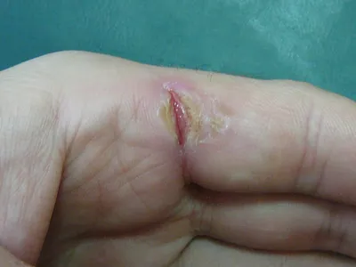 Крем заживляющий раны и трещины для ног Щи Фей Ши (id 77547877), купить в  Казахстане, цена на Satu.kz