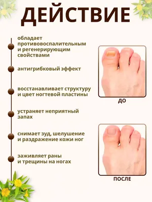 Из-за чего ногти становятся ребристыми – что делать, способы лечения и  профилактики