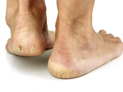 Maybe nail - Правильный домашний уход за ногами 🦶 ⠀ Микоз, трещины на  пятках, мозоли и многие другие проблемы стоп часто возникают из-за  неправильного и недостаточного ухода. Как же правильно ухаживать за