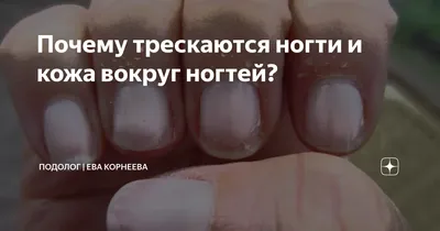 Купить Плакат в кабинет подолога — Трещины на коже в интернет-магазине  rosilak.ru