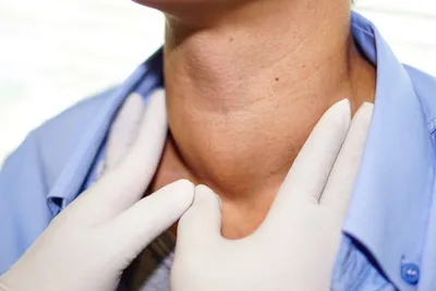 Операции на щитовидной железе: виды, показание, фото | gormoniya