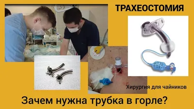 Трахеостомия. Зачем нужна трубка в горле? Хирургия для чайников. - YouTube