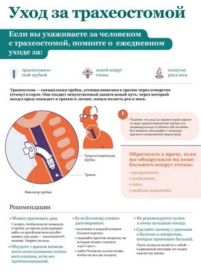 ᐉ Уход за больными с трахеостомой в домашних условиях: алгоритм выполнения