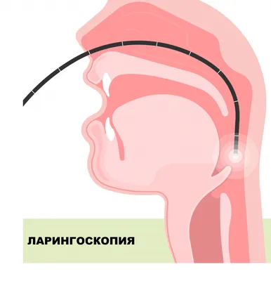 Лимфангиома гортани – причины, симптомы и лечение в Киеве