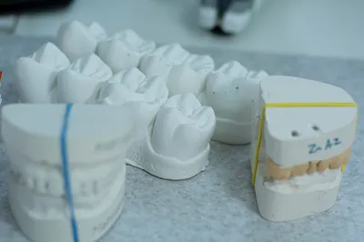 Установка коронок на молочные зубы в Москве | Клиника \"МАЙ\"